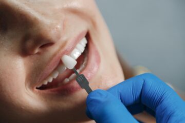 Como marcar consulta pelo SUS para fazer implante dentário gratuito